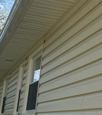 fascia repair long island